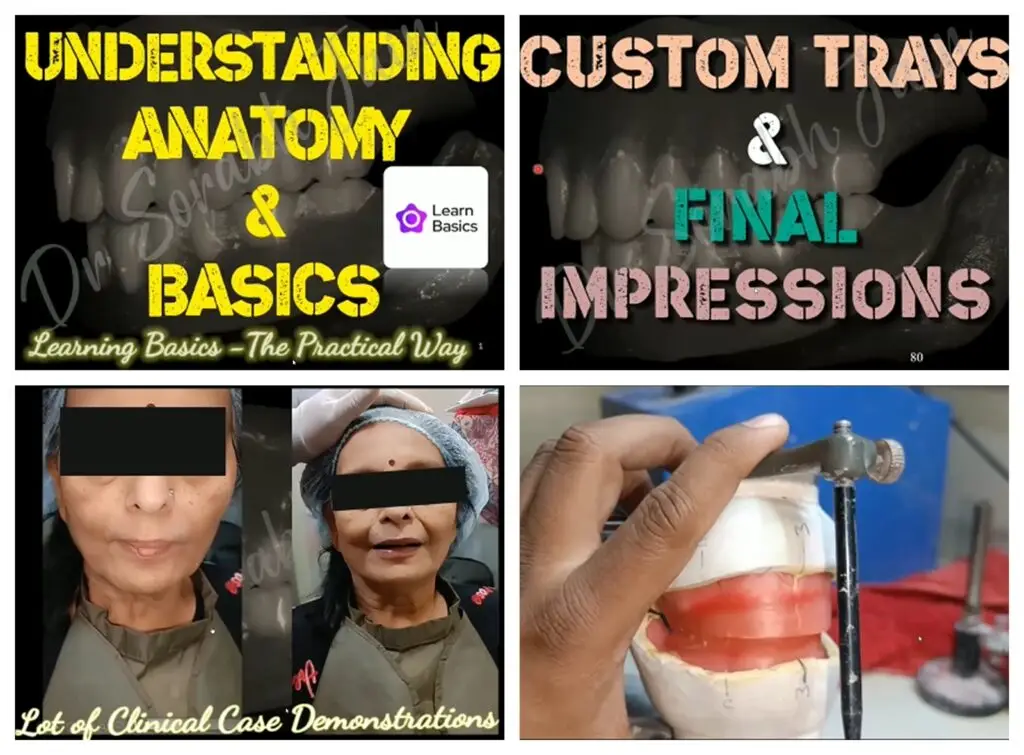 Online Complete Dentures Hacked | Dr Prostho Dental Solution | Manage TMJ Pain
