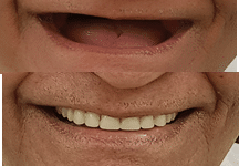 Dr Sorabh R. Jain | Prosthodontist and TMJ specialist dentist in Kandivali East Mumbai
