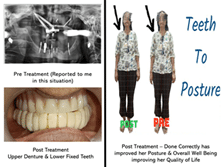 Dr Sorabh R. Jain | Prosthodontist and TMJ specialist dentist in Kandivali East Mumbai
