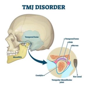Dr Prostho Dental Clinic | Manage TMJ Pain