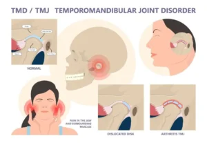 Dr Prostho Dental Clinic | Manage TMJ Pain