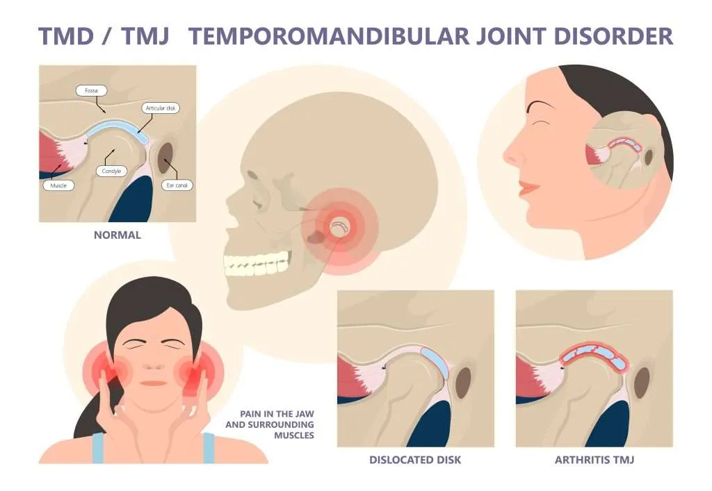 Dr Prostho Dental Clinic | Manage TMJ Pain