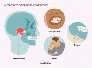 Dr Prostho Dental Clinic | Manage TMJ Pain