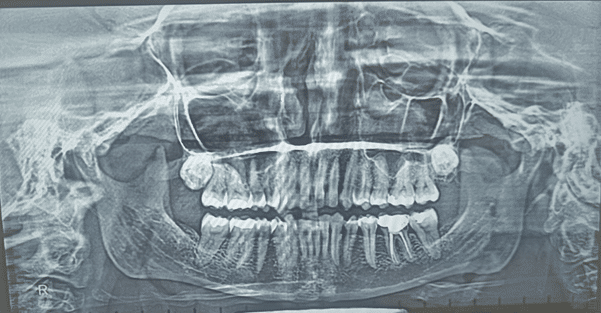Dr Sorabh R. Jain | Jaw Pain Muscle Pain Treatment in Mumbai