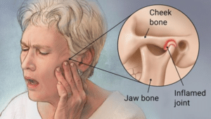 Dr Sorabh R. Jain | TMJ Jaw Locking Treatment in Mumbai