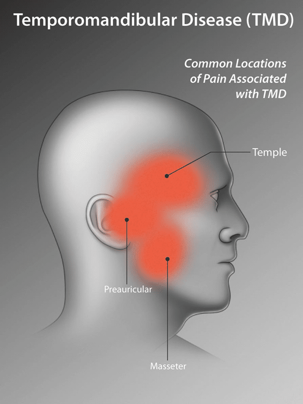 Dr Sorabh R. Jain | TMJ-Jaw Locking Treatment in Mumbai