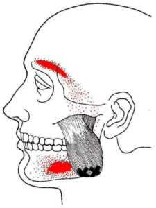 Dr Sorabh R. Jain | TMJ-Jaw Locking Treatment in Mumbai