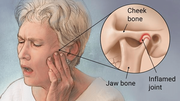 Dr Sorabh R. Jain | TMJ Jaw Locking Treatment in Mumbai