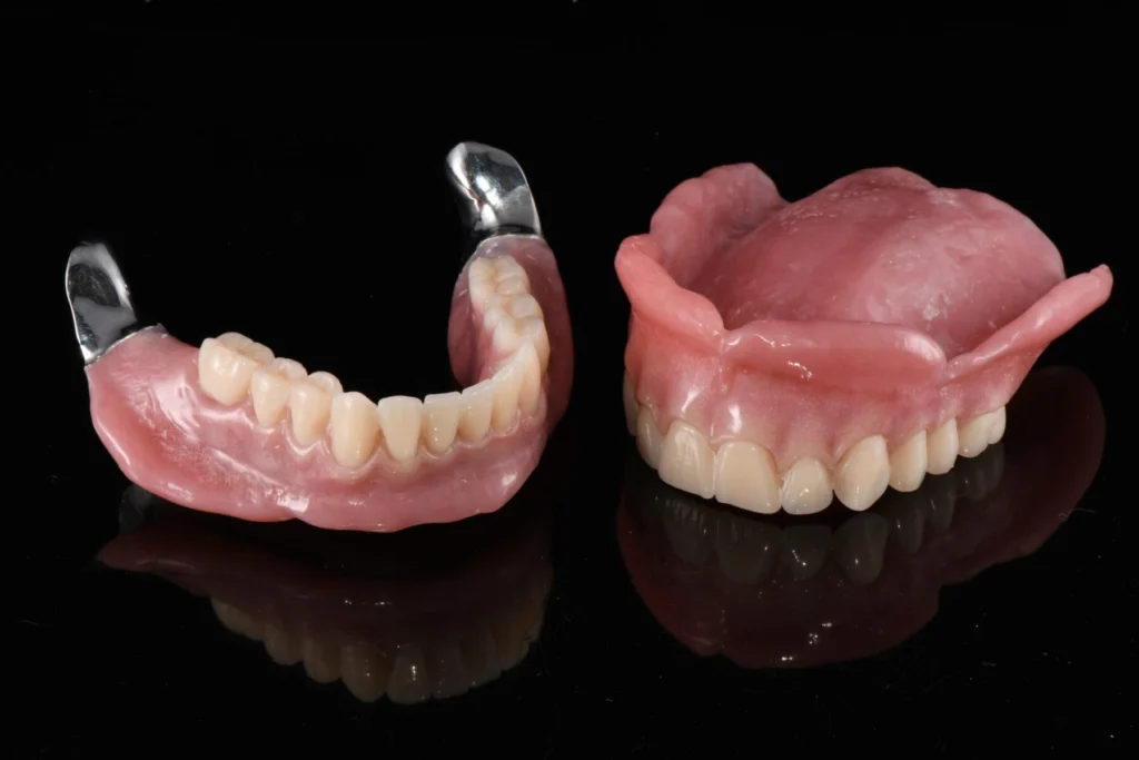 Complete dentures Mumbai, neuromuscular dentures, ill-fitting dentures Mumbai