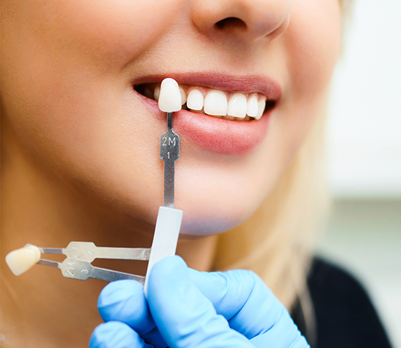 Smile design Mumbai, cosmetic dentistry Mumbai, cosmetic caps Mumbai