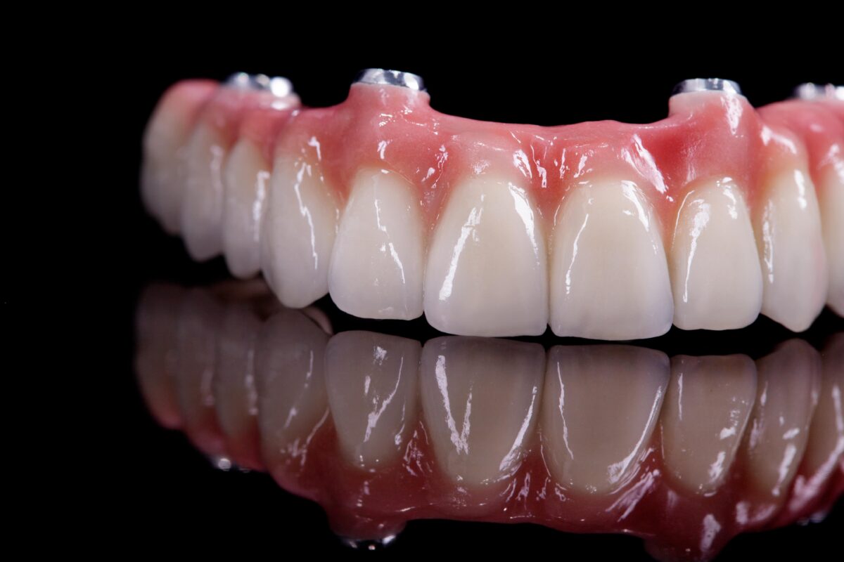 Maxillofacial prosthetics Mumbai, oral cancer rehabilitation Mumbai